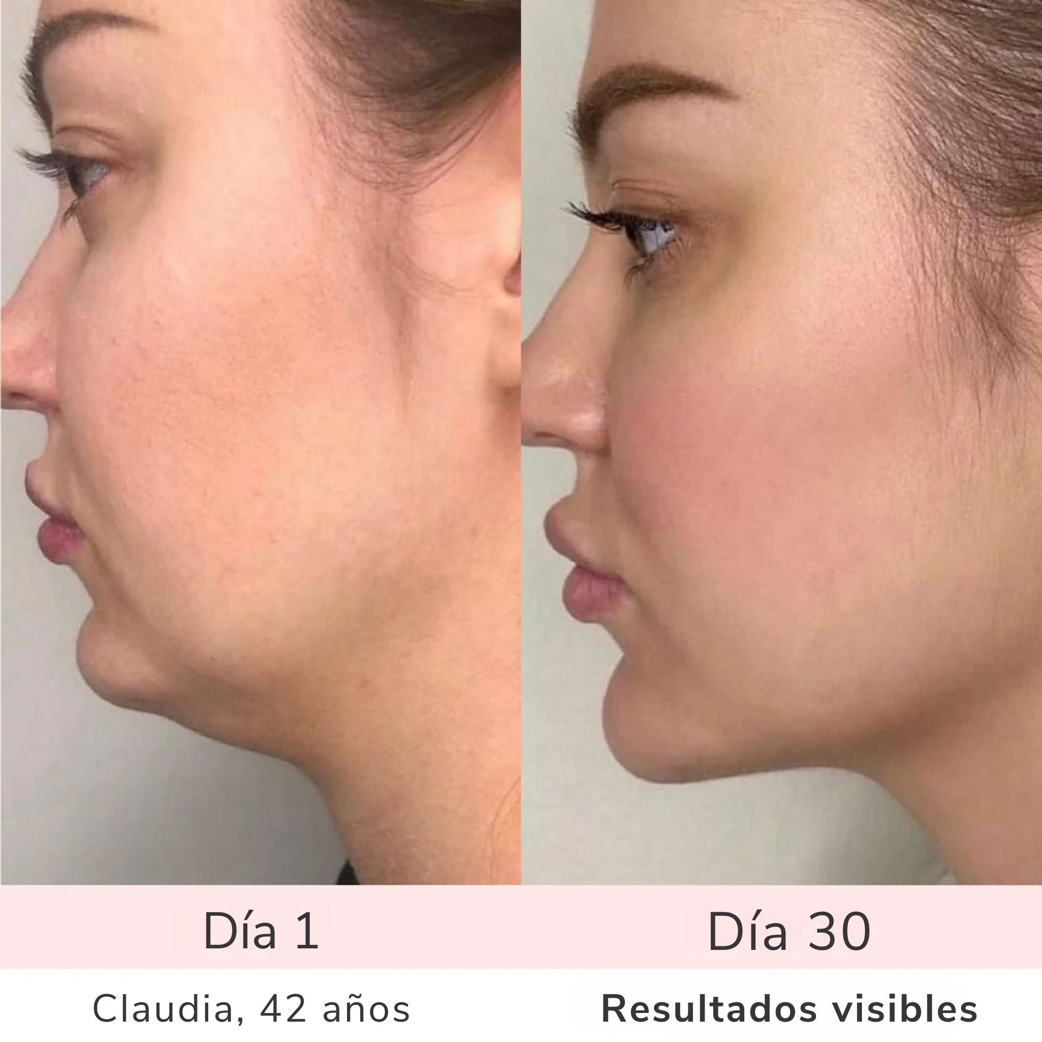 LumiSkin – Para una piel radiante, suave y firme