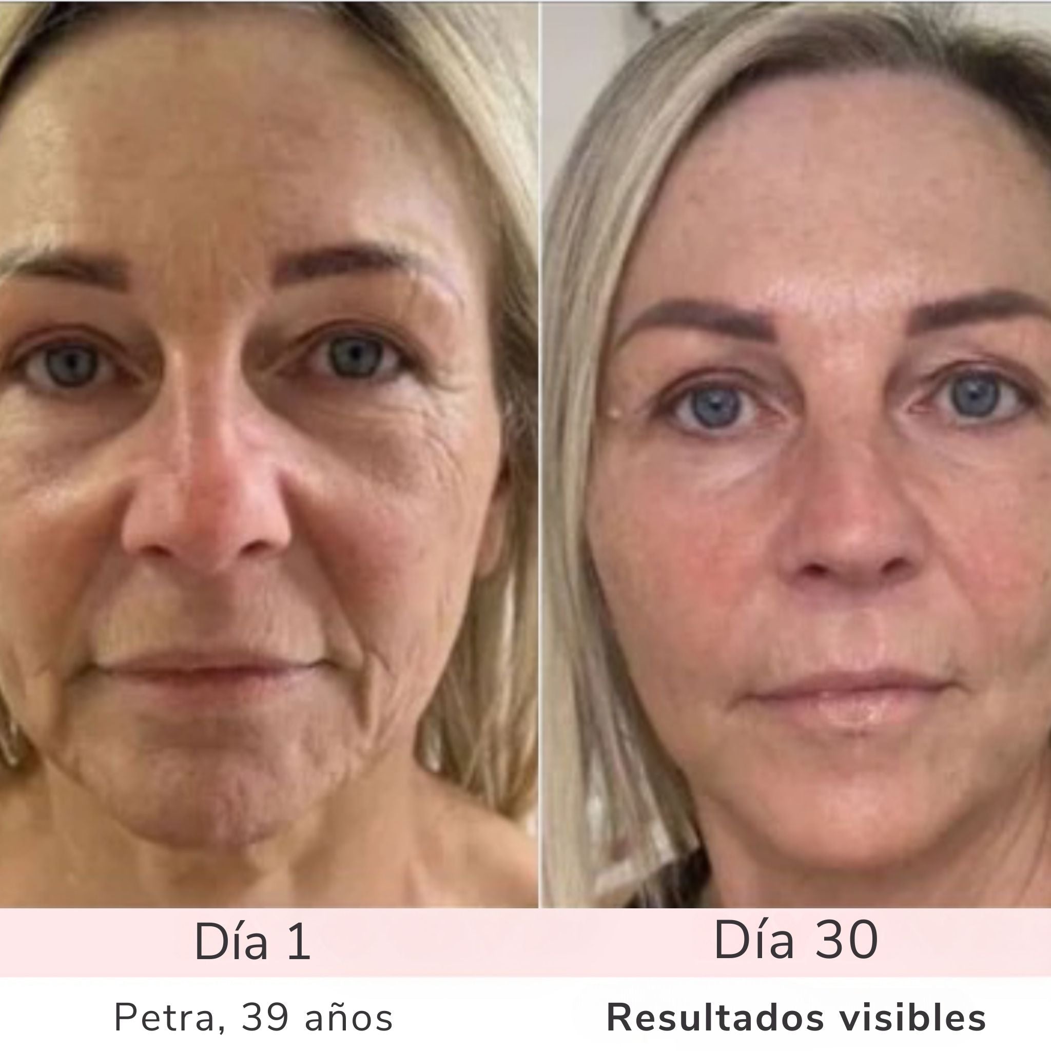 LumiSkin – Para una piel radiante, suave y firme