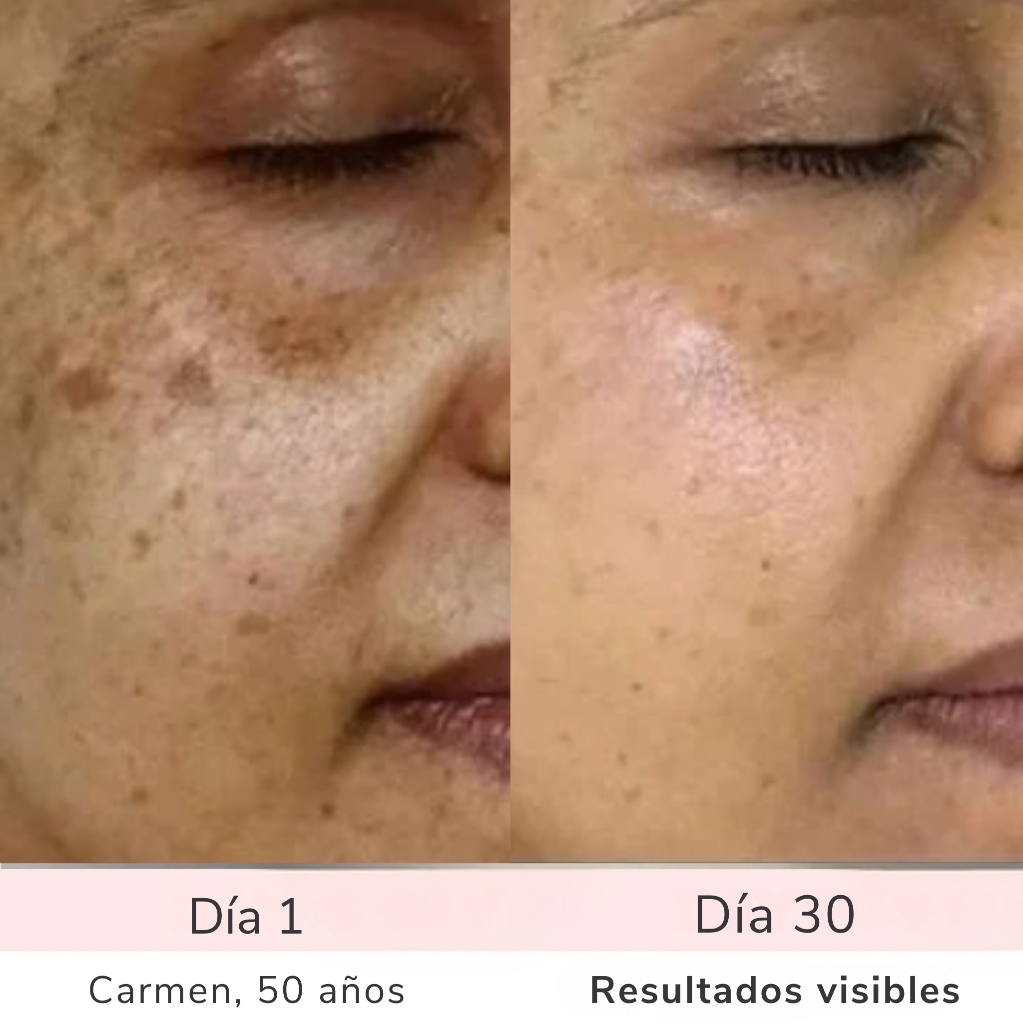 LumiSkin – Para una piel radiante, suave y firme