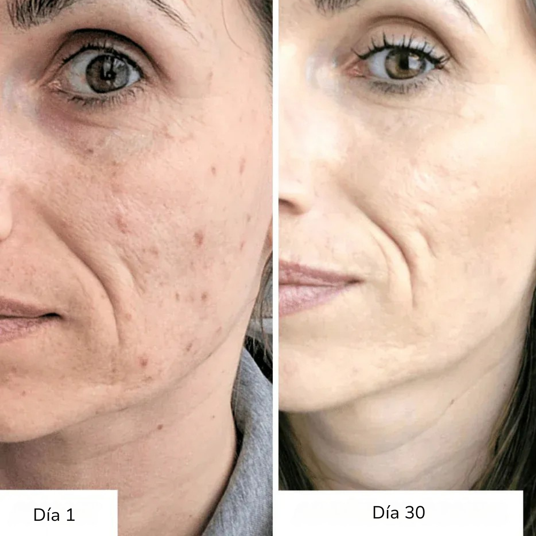 LumiC Glow – Sérum Vitamina C – Ilumina y rejuvenece la piel (OFRECIDO con tu pedido de hoy)