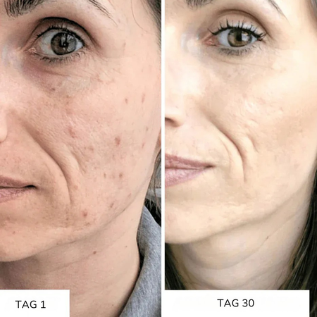 LumiC Glow - Vitamin-C Serum